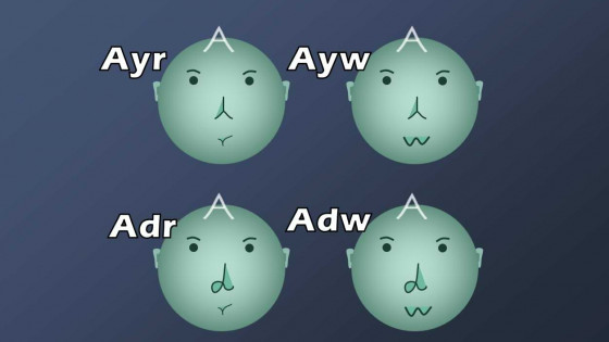 Epitopes (Antigenic Determinents) - Serological subtypes (Serotypes) of Hepatitis B virus