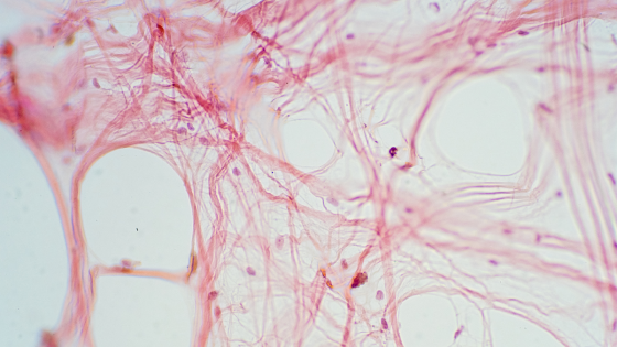 Hur mår din Fascia?