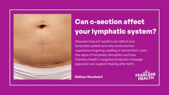 Can a c-section affect your lymphatic system? What you need to know.