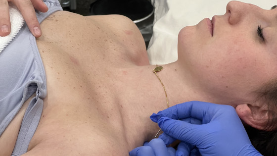 We offer Dry Needling at Wellilo