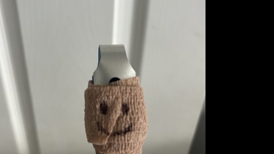 3 Observations I Made About Grief After I Sliced Off My Finger