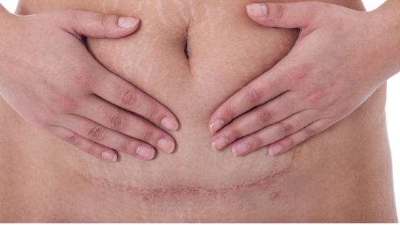 What Your Body Looks Like Post Baby
