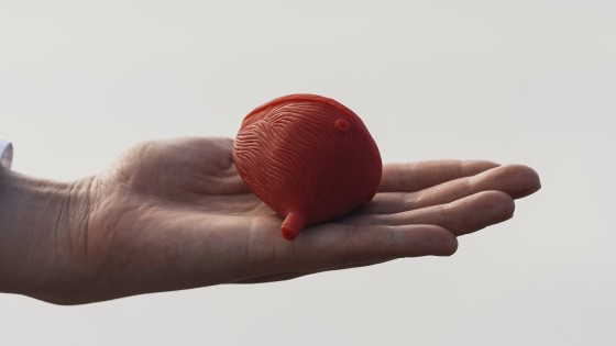 Raskausajan virtsankarkailu: syyt, ratkaisut ja helpotukset