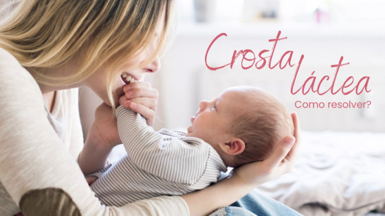 Crosta Láctea