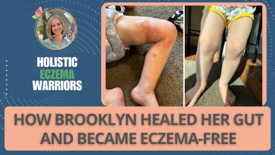 How Brooklyn Healed Her Gut and Became Eczema Free