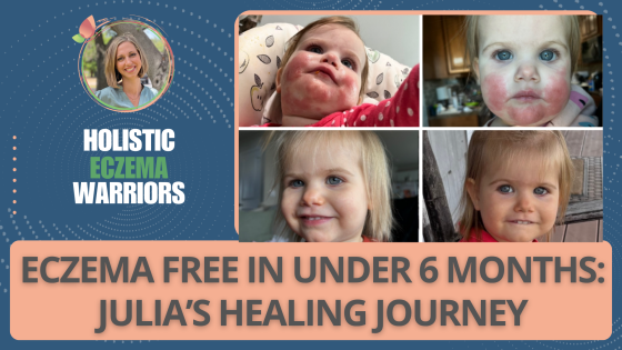 When Allergies Aren’t the Root Cause: Julia’s Eczema Healing Story