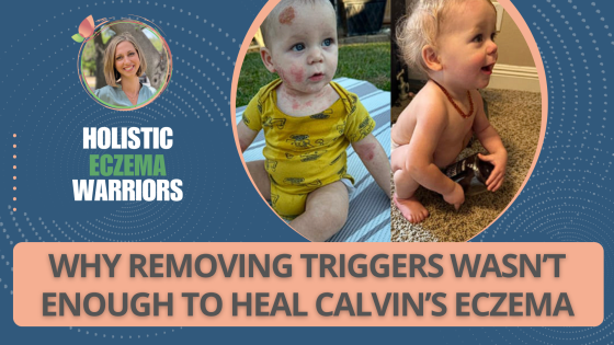 Why Removing Triggers Wasn’t Enough to Heal Calvin’s Eczema