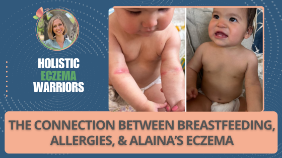 The Hidden Connection Between Breastfeeding, Allergies, and Alaina’s Eczema